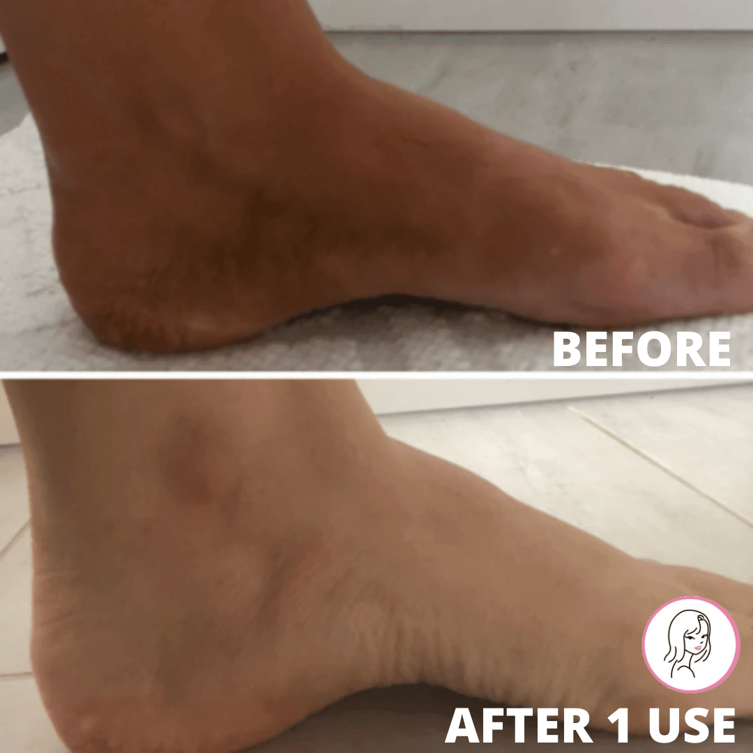 SKINSOLUTIONS EXFOLIATING GLOVE