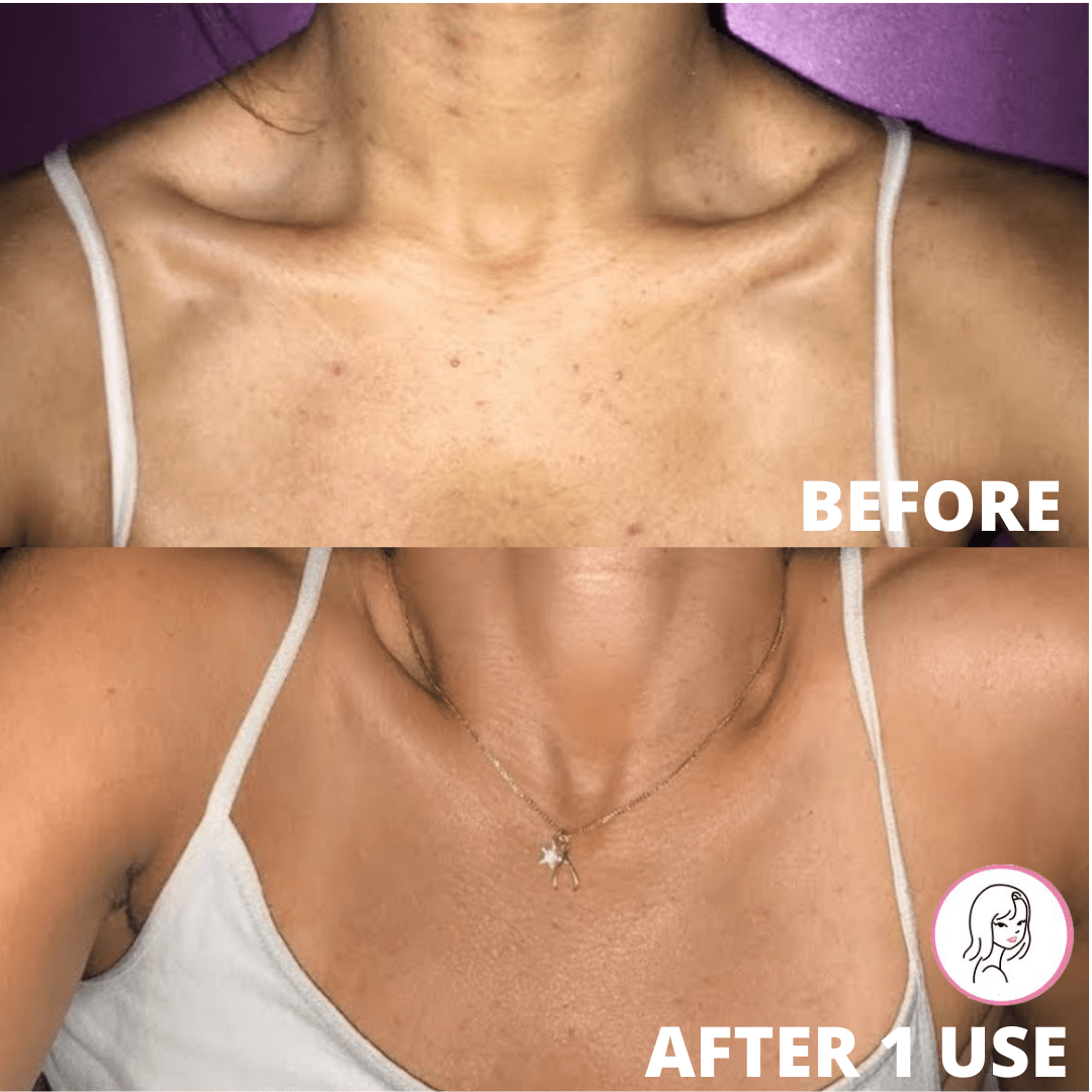 SKINSOLUTIONS EXFOLIATING GLOVE